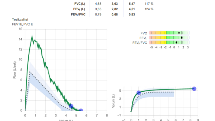 Web Spirometri