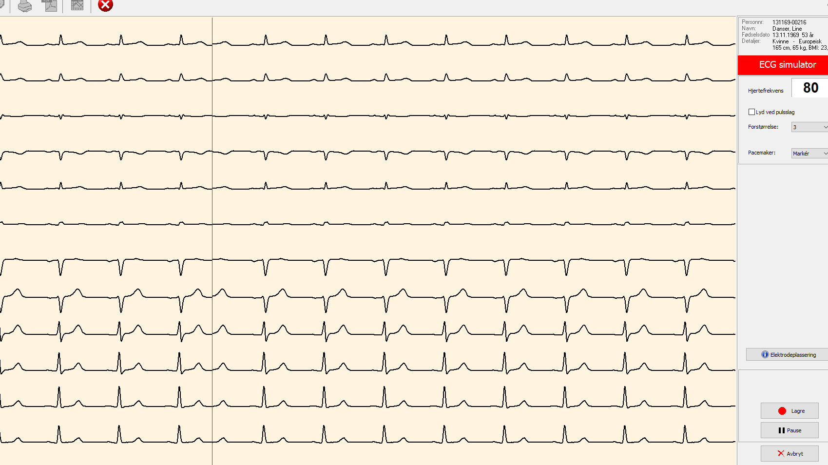 Slik tar du EKG i PC-klienten